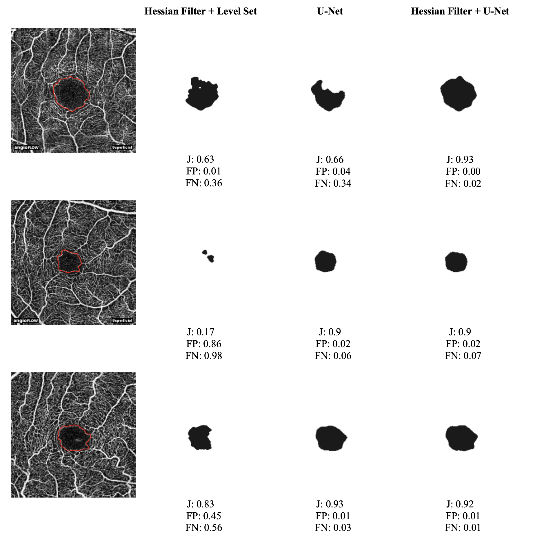 Segmentation output examples