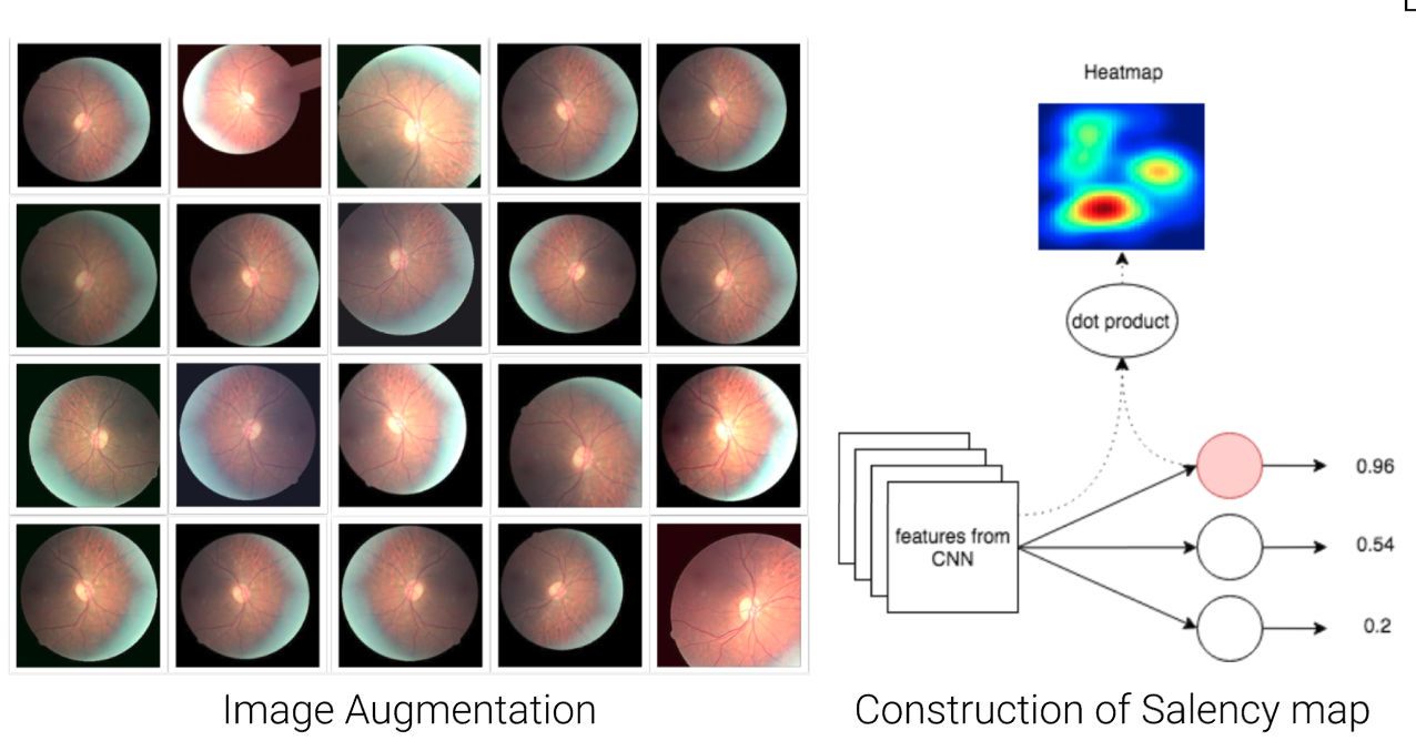 Data augmentation examples and saliency maps