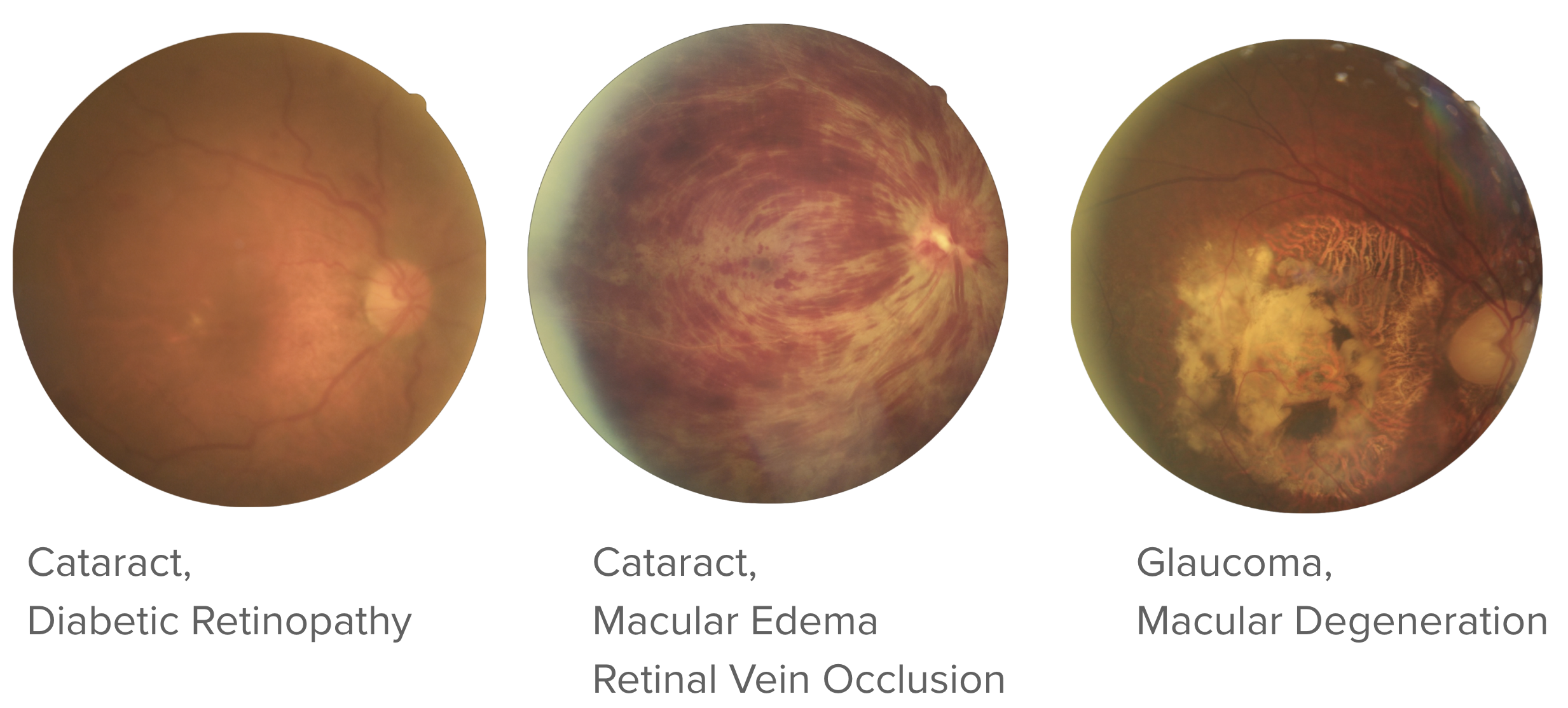 Distribution of disease labels in MuDaRI