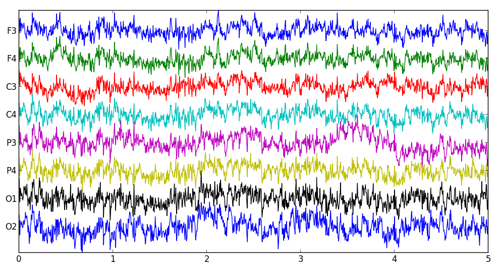 Raw EEG signal traces