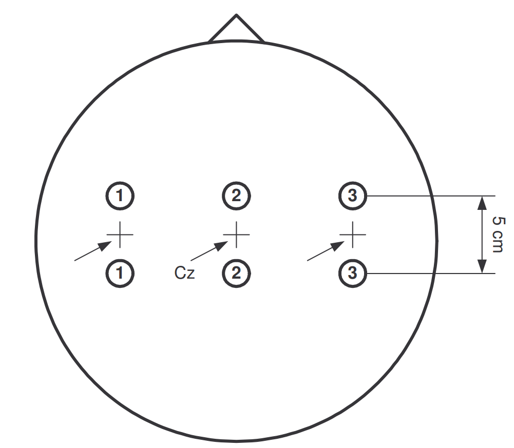 EEG electrode placement