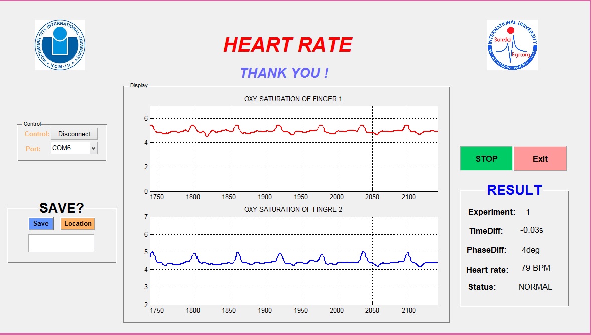 MATLAB two-channel result