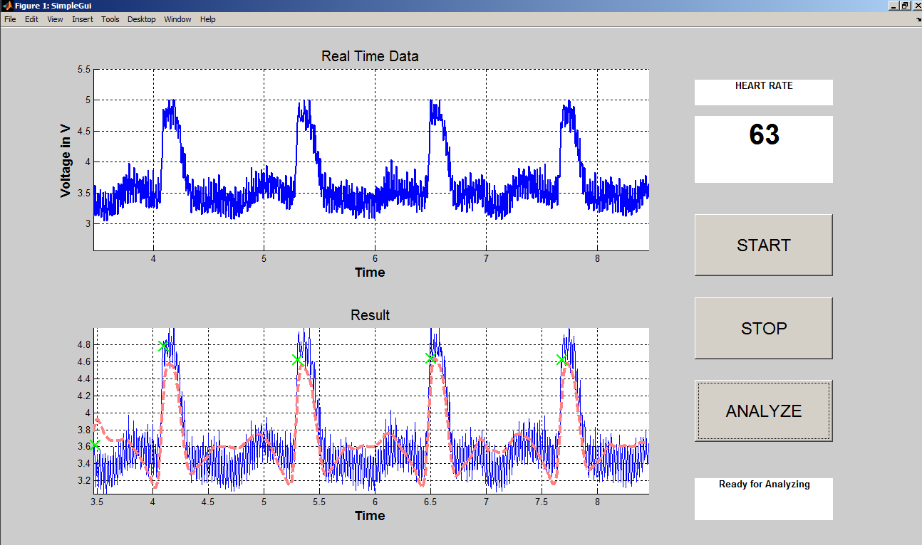 MATLAB real-time UI